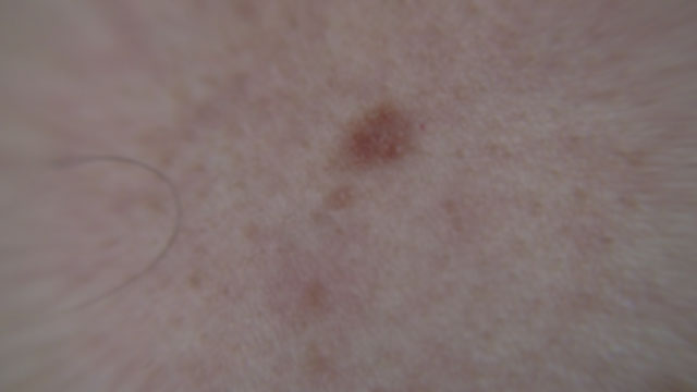 5242010 project image 12